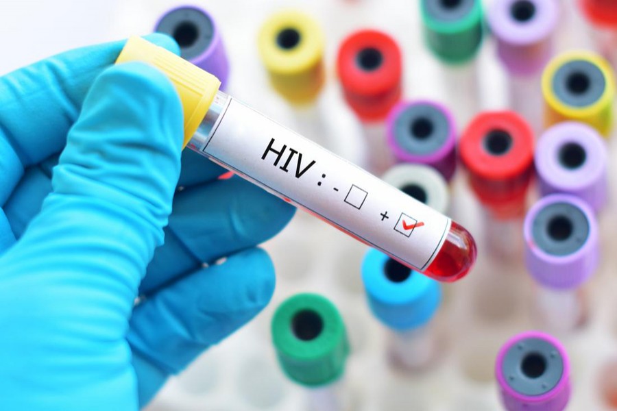 193 test positive for HIV: Report