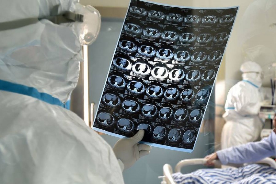    A doctor checks the CT report of a confirmed patient of novel coronavirus pneumonia in Lhasa, southwest China's Tibet Autonomous Region   