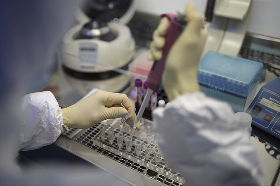 A medical staffer works with test systems for the diagnosis of coronavirus in Krasnodar, Russia — AP/Files