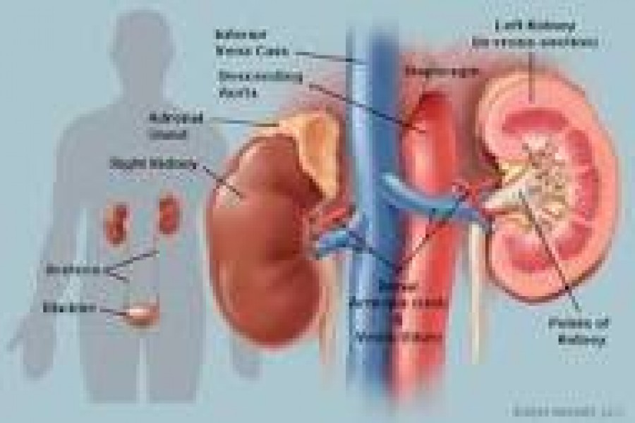 Over 20m kidney patients, only 10 pc get treatment