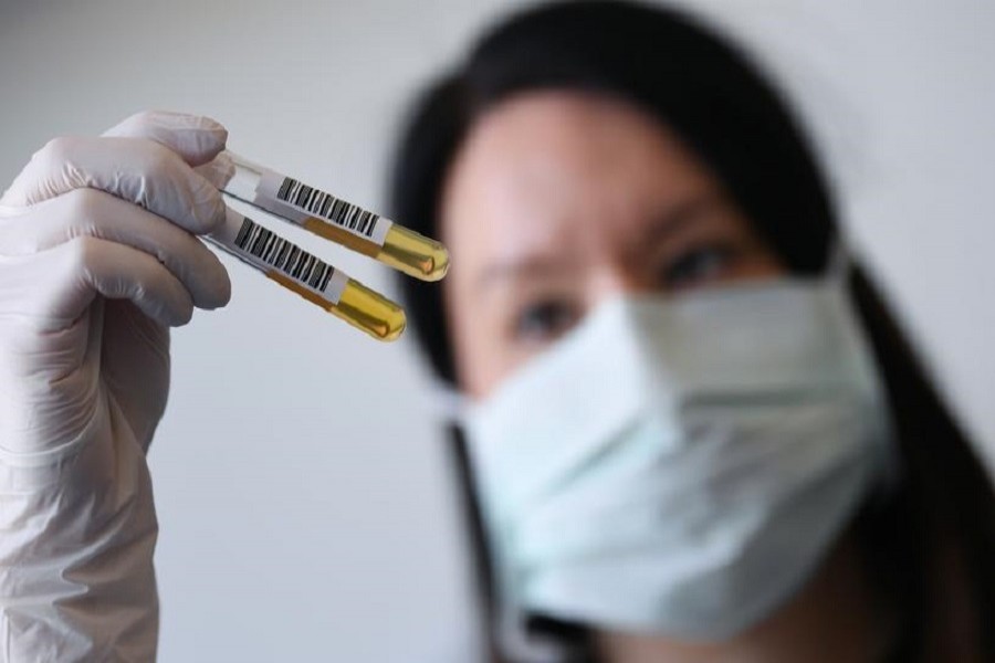 A member of the medical staff shows a used sample container at a test centre for coronavirus disease (COVID-19) at Havelhoehe community hospital in Berlin, Germany, April 06, 2020. – Reuters/Files