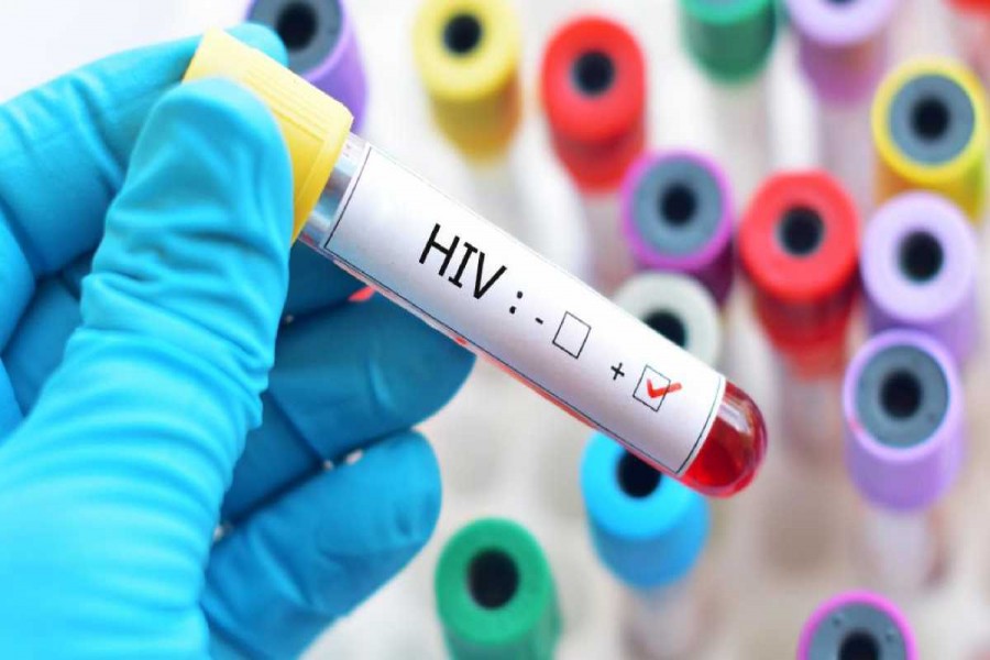 Dhaka witnesses highest concentration of HIV-positive people in Bangladesh