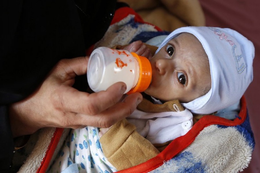 A mother feeds her malnourished child at Al-Sabeen hospital in Sanaa, Yemen, Oct. 21, 2020. (Photo by Mohammed Mohammed/Xinhua)