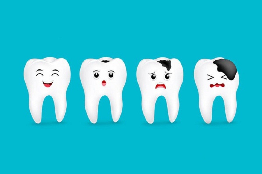 Roots and risks of tooth decay