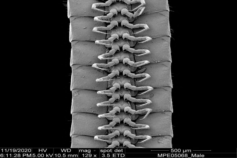 A microscope view of the legs of a male individual of the newly identified millipede species Eumillipes persephone discovered deep underground in Australia is seen in this undated photograph. Marek et al/Scientific Reports/Handout via REUTERS