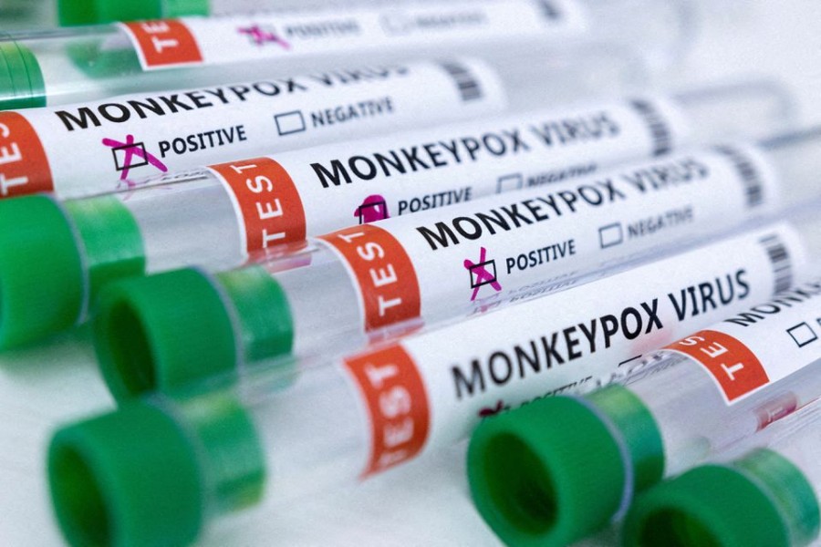 FILE PHOTO: Test tubes labeled "Monkeypox virus positive and negative" are seen in this illustration taken May 23, 2022. REUTERS/Dado Ruvic/Illustration