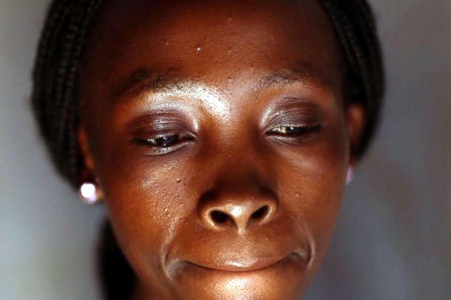 In this file photo, Bora, 22, poses for a portrait in the Congo Ituri province capital Bunia. Bora said she was just 11 when she became pregnant by her rapist, a UN peacekeeper. – AP photo
