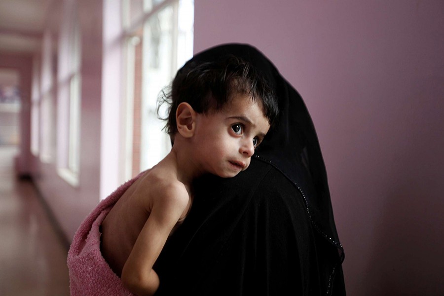 A woman holds her malnourished boy after he was weighed at a hospital malnutrition intensive care unit in Sanaa, Yemen on September 27, 2016. - Reuters file photo