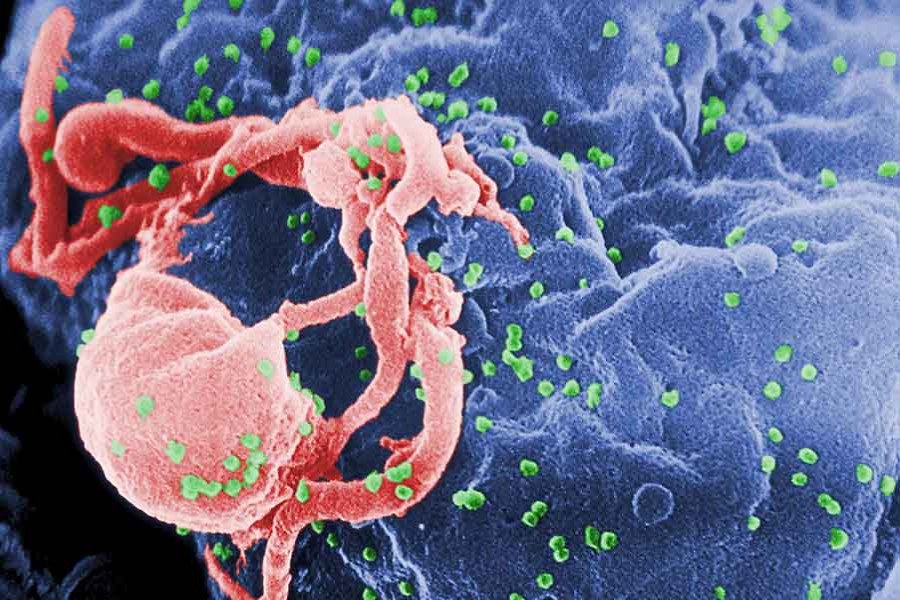 Representational image of HIV virus