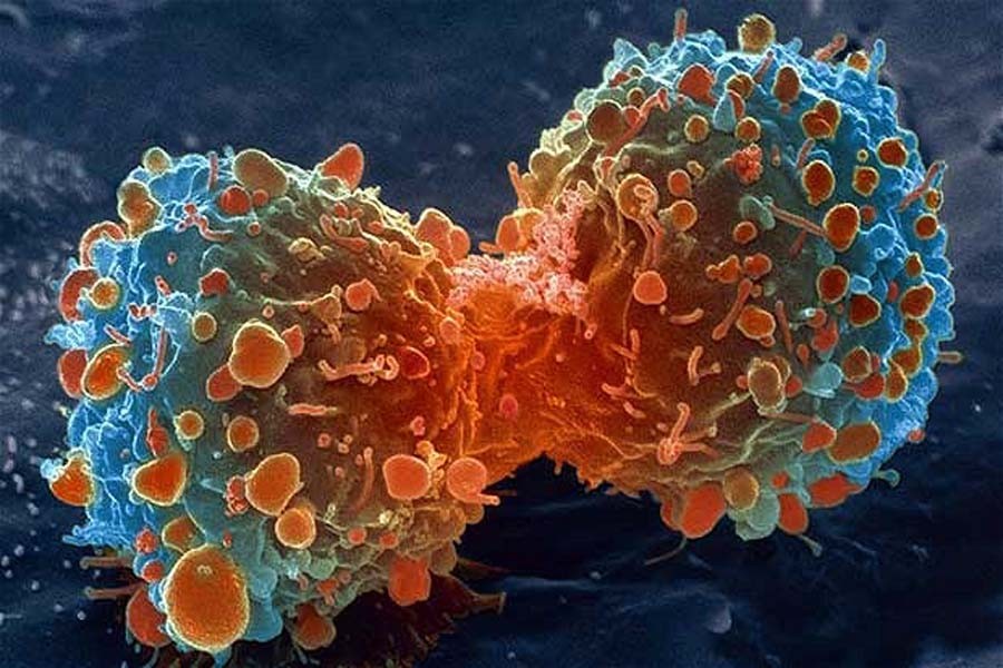 Fight against cancer by living right: Study