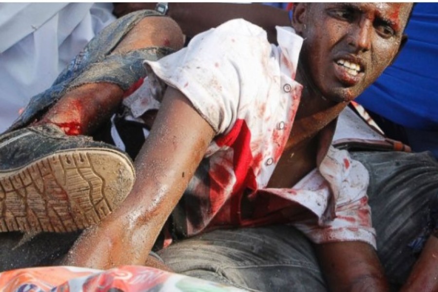 An injured civilian who was wounded during a car bombing in Mogadishu, Somalia Thursday, March 22, 2018.