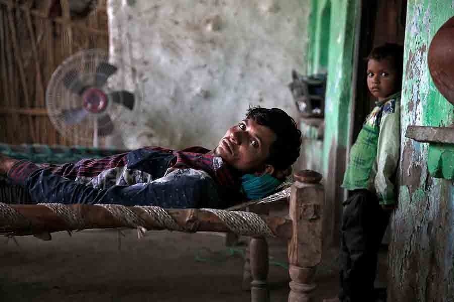 Mohammed Rafiq, 25, who was beaten by cow vigilantes in the attack that killed Pehlu Khan, recovers at his home in Jaisinghpur in early June. Reuters photo