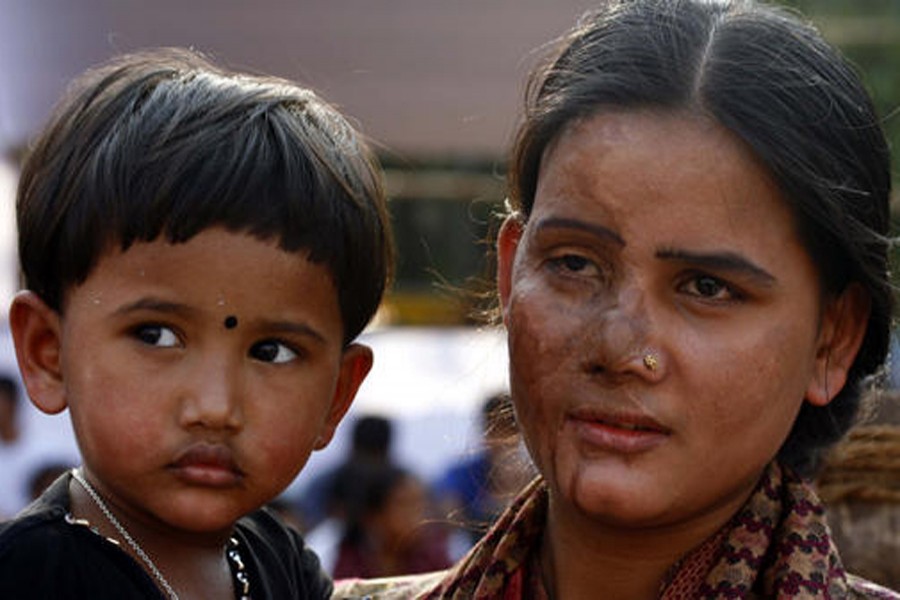 Acid attack survivor with her child in Bangladesh. Image derived from Amnesty International