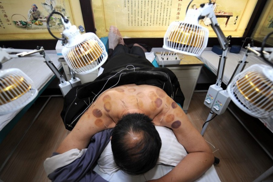 A patient under TCM treatment. Photo: Collected