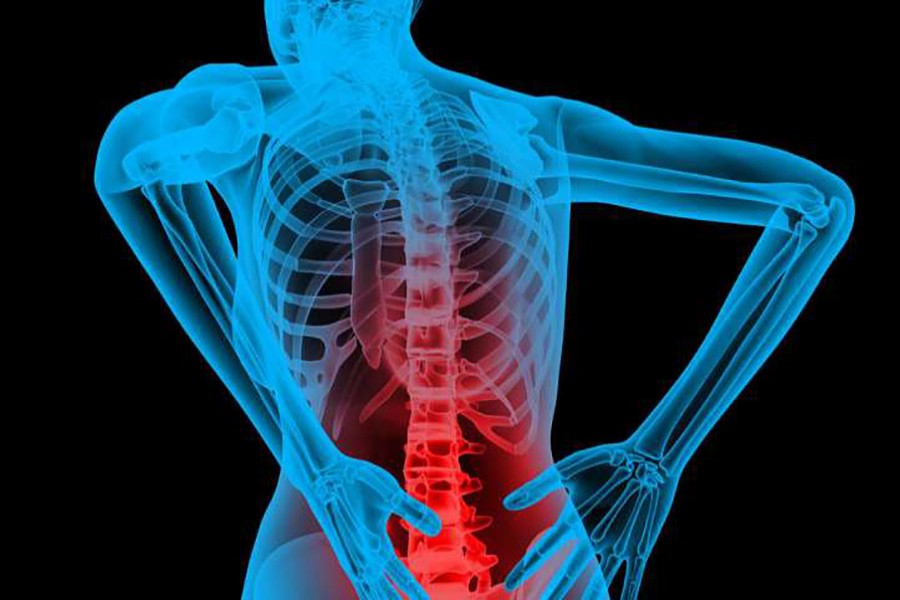 Study shows link between diabetes and back pain