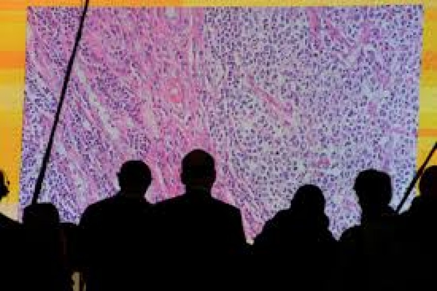 FILE PHOTO: Cancer cells are seen on a large screen connected to a microscope at the CeBit computer fair in Hanover, Germany, March, 6, 2012. REUTERS/Fabian Bimmer/File Photo