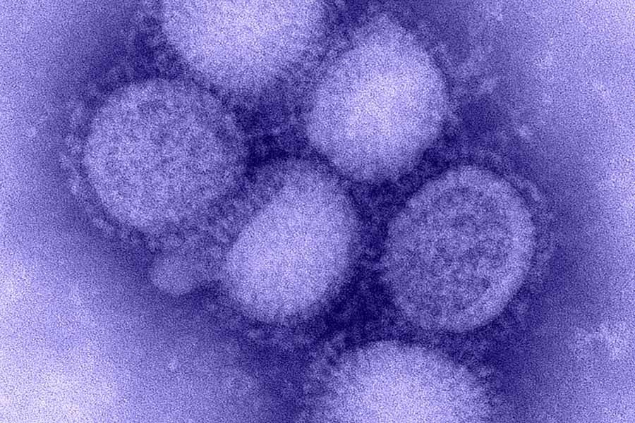 Swine flu does not exist in globe, IEDCR says