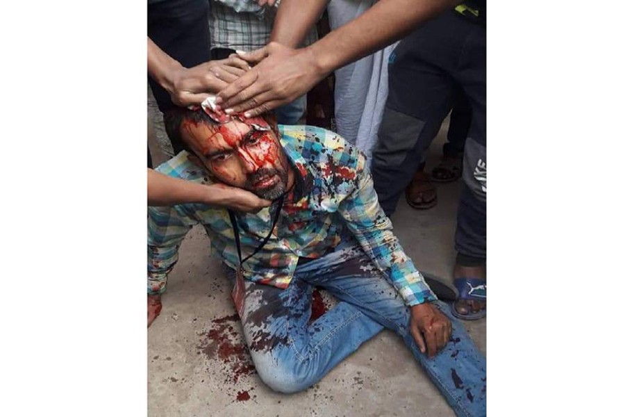 Mostafizur Rahman Sumon, a reporter of agami.com, was attacked allegedly by followers of an Awami League-backed councillor candidate at Rayerbazar Sadek Khan Road in the city's Mohammadpur on Saturday morning--UNB Photo