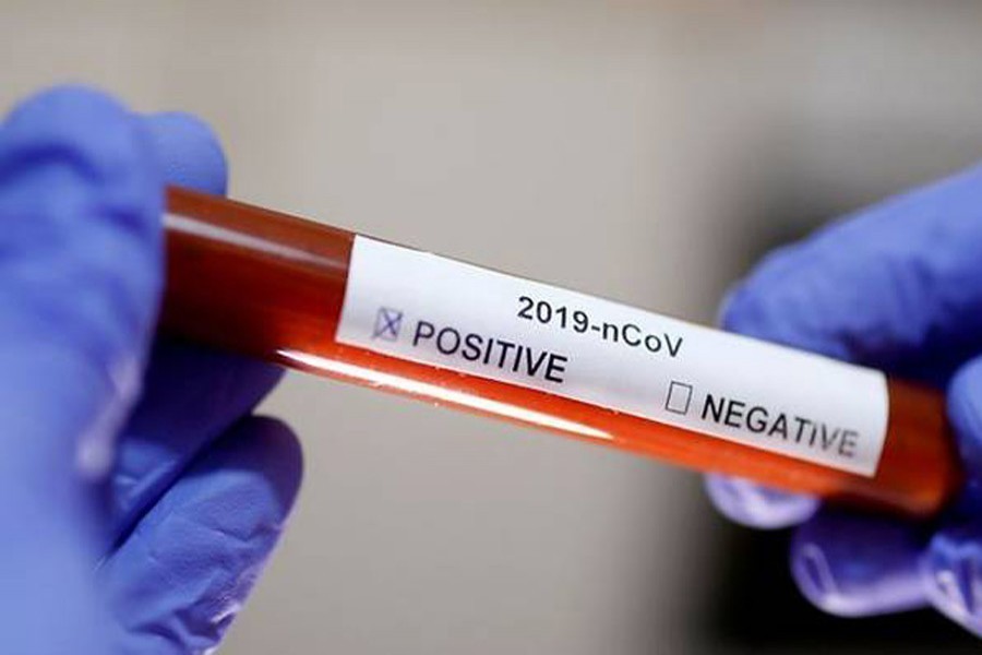Test tube with the coronavirus name label is seen in this illustration taken on January 29, 2020 — Reuter/Files