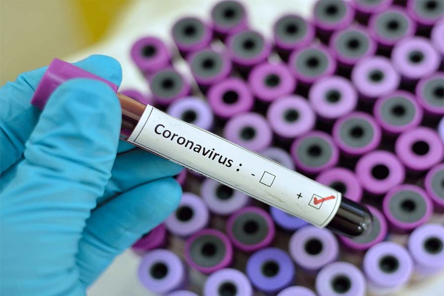 US steps up coronavirus therapy development