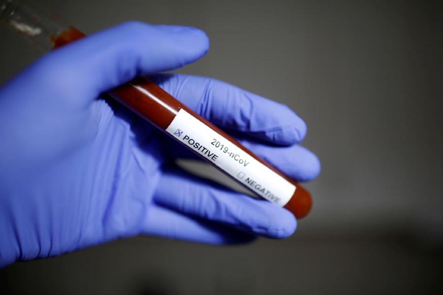 Test tube with Coronavirus name label is seen in this illustration taken on January 29, 2020 — Reuters/Files
