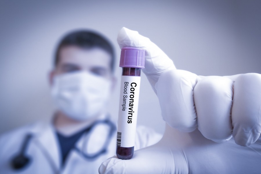 Cop tests positive for coronavirus in Jhalakati
