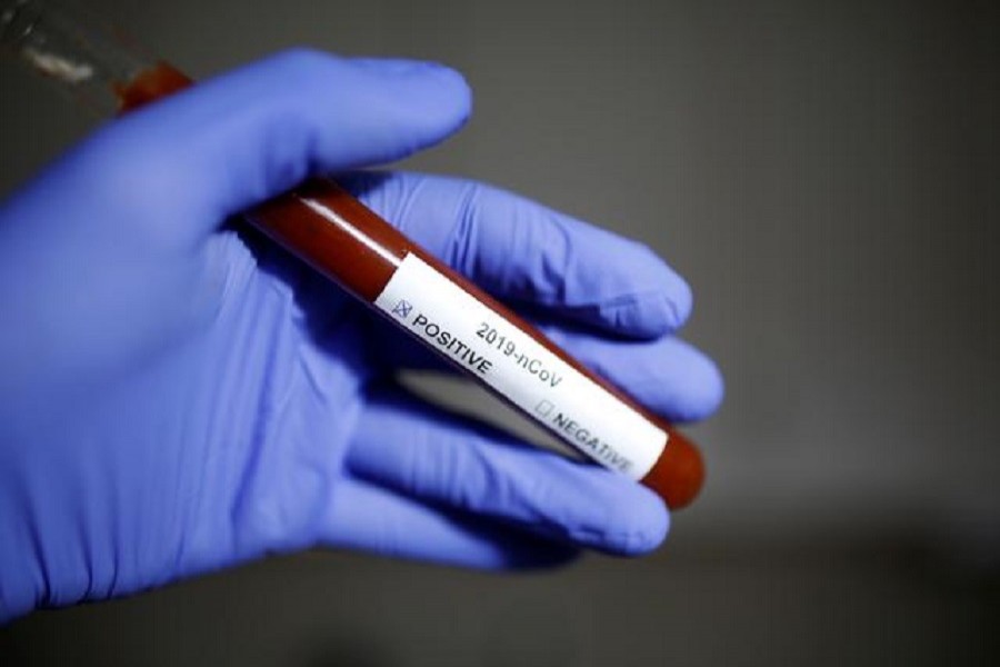 Test tube with coronavirus name label is seen in this illustration taken on January 29, 2020. — Reuters/Files