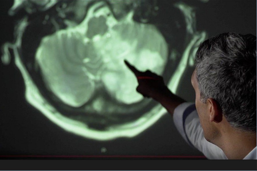 A consultant neurologist points out brain damage on a scan. Photo source: BBC