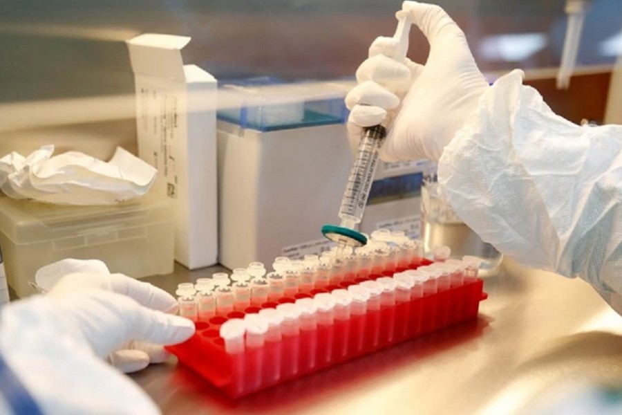 Results of Russia's COVID-19 vaccine produced antibody response