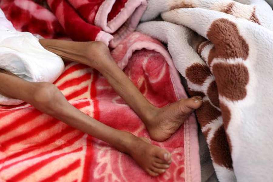 400,000 Yemeni children could die of starvation this year, UN warns