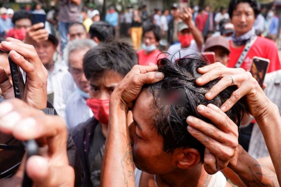 A man shows an injury after the police fired rubber bullets during protests against the military coup, in Mandalay, Myanmar, Feb 20, 2021. REUTERS