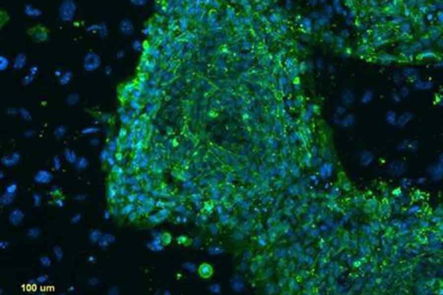 A fluorescent microscope image shows human embryonic stem cells in this photo taken at Stanford University and released by the California Institute for Regenerative Medicine in 2009. –Reuters file photo