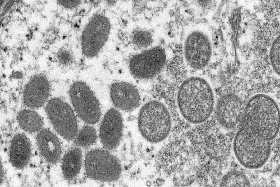 UAE detects first case of monkeypox