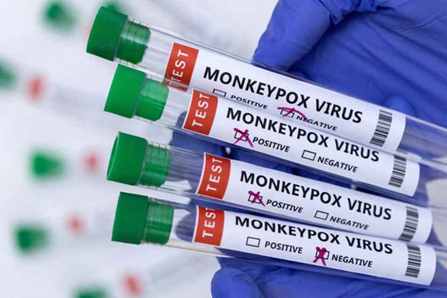 Test tubes labelled "Monkeypox virus positive and negative" are seen in this illustration taken May 23, 2022. REUTERS/Dado Ruvic/Illustration/File