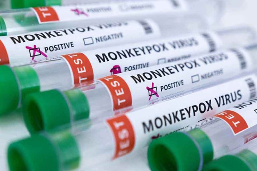 Illustration shows test tubes labelled "Monkeypox virus positive and negativeTest tubes labelled "Monkeypox virus positive and negative" are seen in this illustration taken May 23, 2022. REUTERS/Dado Ruvic/Illustration