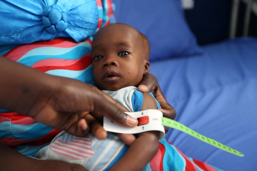 A muac tape used to screen malnutrition in children at the stabilisation ward in Molai General Hospital Maiduguri, Nigeria November 30, 2016. REUTERS/Afolabi Sotunde