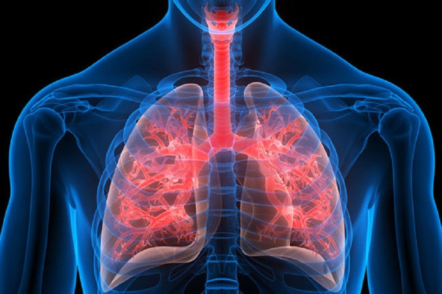 Rise of lung diseases - symptoms and precautions