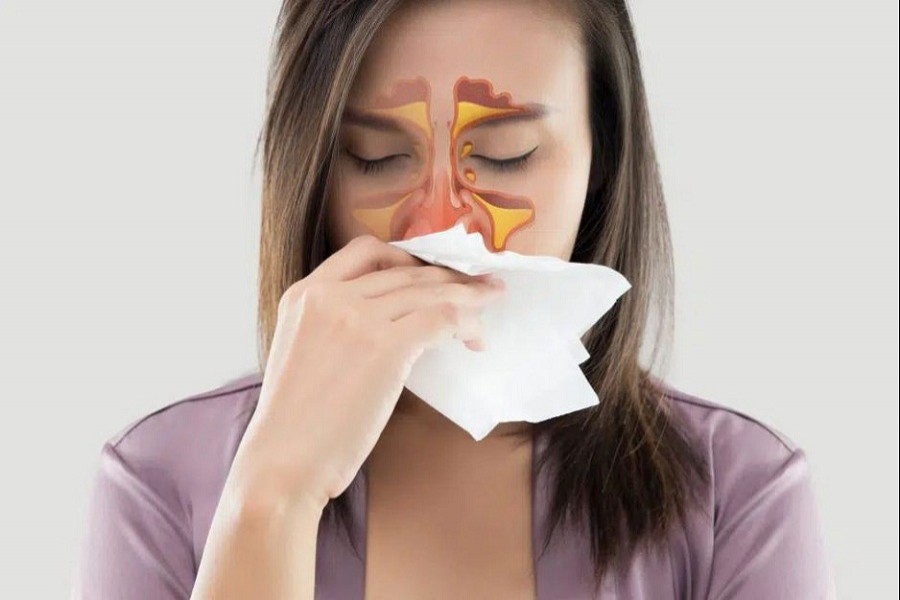 Dealing with stuffy nose during winter