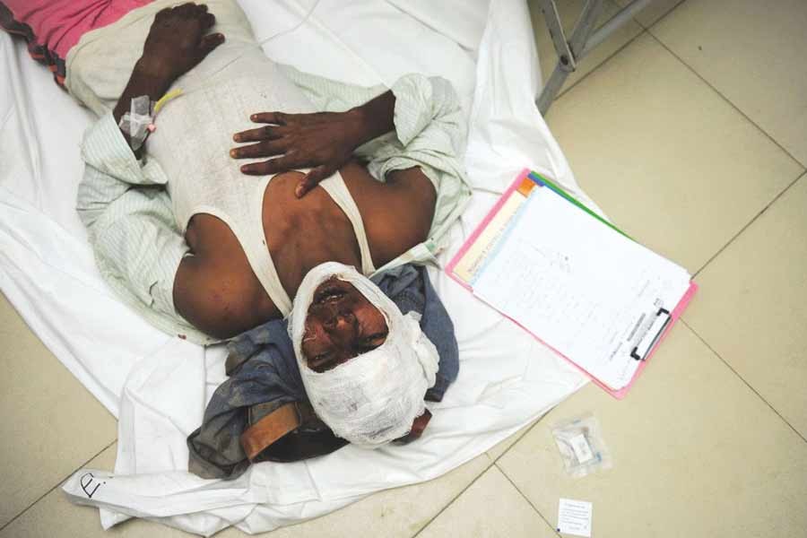 A seriously injured person at a hospital floor in Dhaka    —Agency Photo
