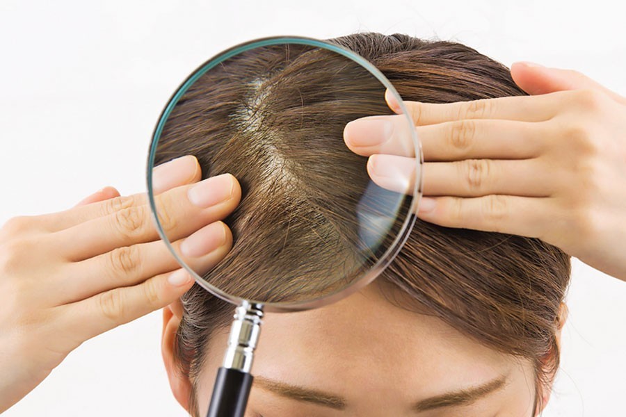 Improving blood flow in scalp helps hair growth