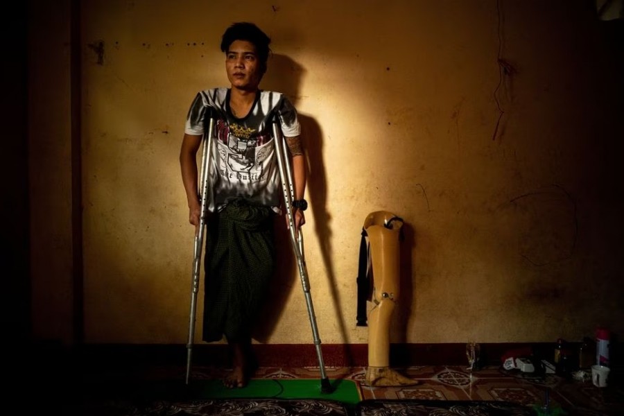 Aye Chan, a former factory worker turned resistance fighter who lost his leg fighting against the military, stands on crutches as he poses next to his prosthetic leg during an interview with Reuters in an undisclosed location on January 27, 2023 — Reuters photo